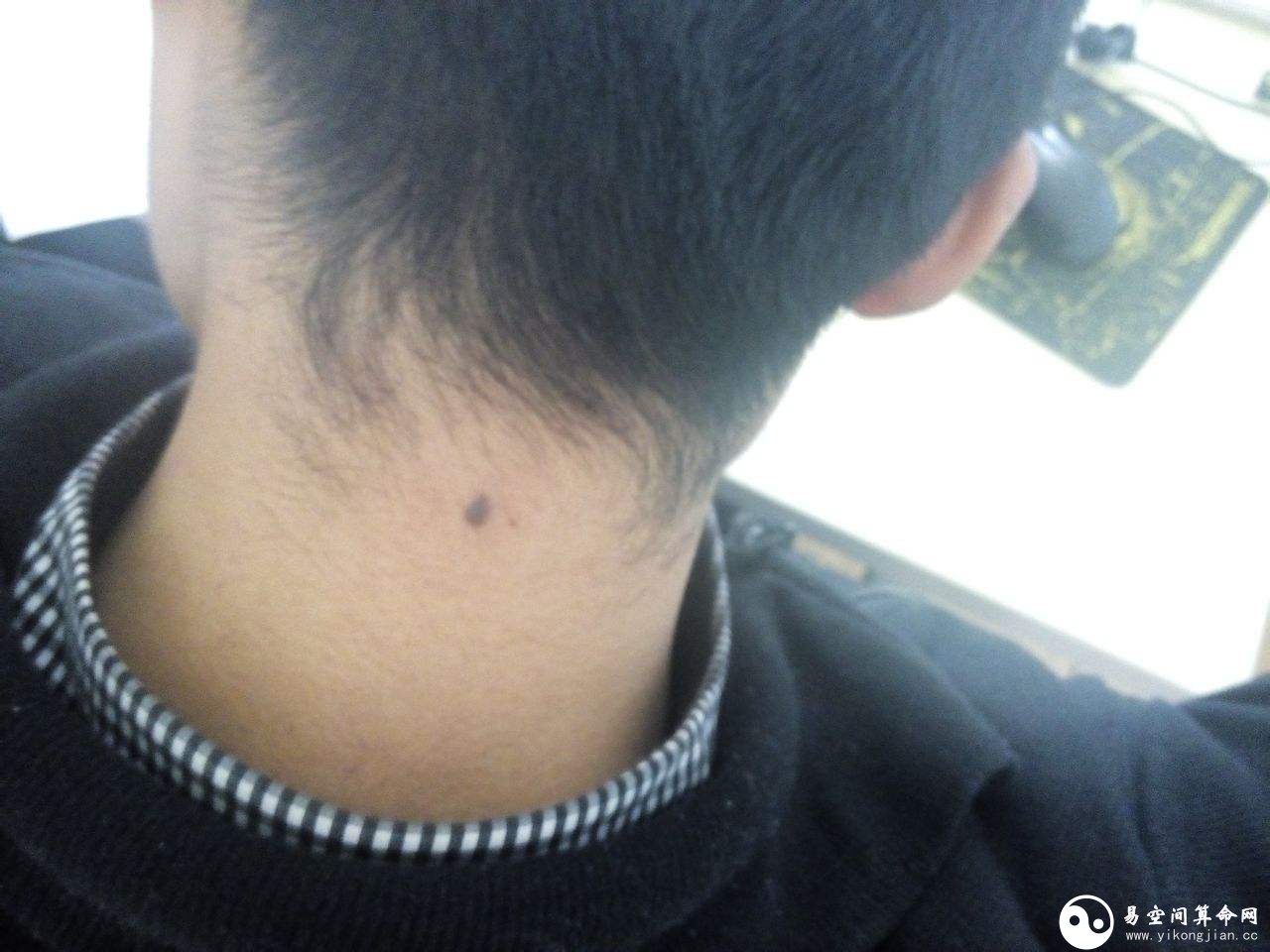 脖子上有痣的男人代表什么 脖頸上右側(cè)有長痣代表什么