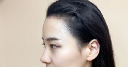 女性額頭寬大發(fā)際線高面相好不好？