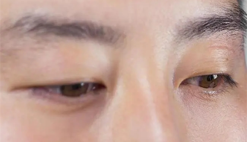 男人的左眼跳是什么預(yù)兆 男人左眼跳是財(cái)還是災(zāi)