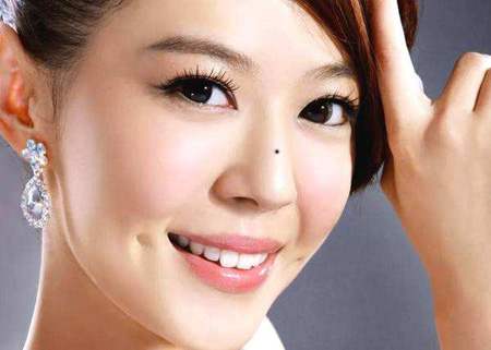 臉上什么地方的痣不能去掉