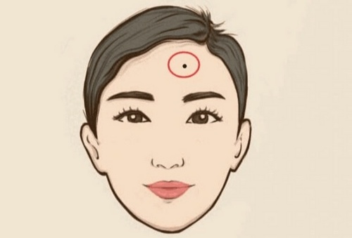 臉上什么地方的痣不能去掉