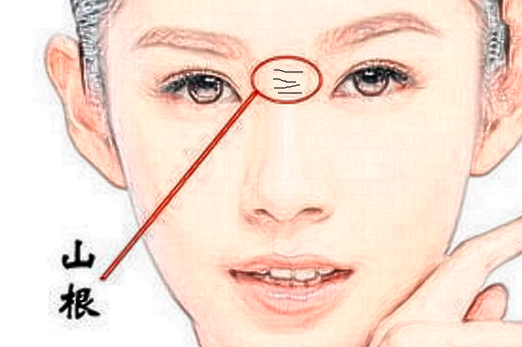 鼻梁上有橫紋怎么回事