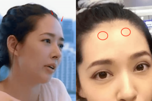 面相額頭有骨隆起說(shuō)法