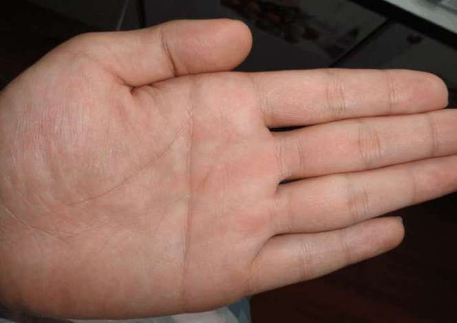 斷掌紋的男人命運怎么樣