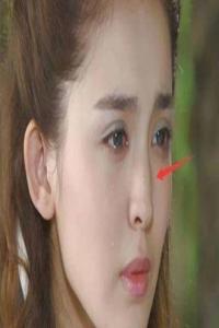 鼻梁有節(jié)的女人命運
