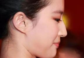 鼻梁上有個小駝峰的女人