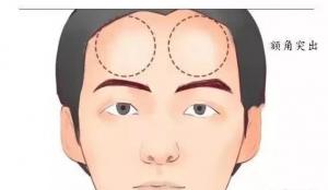 額頭有兩個凸起的骨頭面相