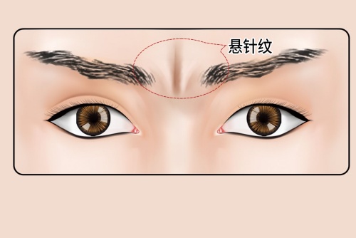 臉上有一紋,可看生死,你知道嗎?