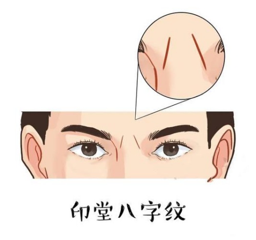 臉上有一紋,可看生死,你知道嗎?