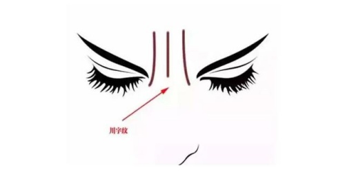 臉上有一紋,可看生死,你知道嗎?