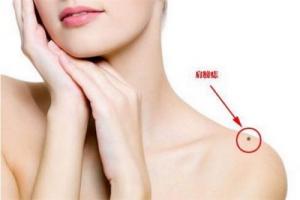 肩膀上有痣代表什么意思