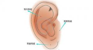 耳朵有痣圖解對照表