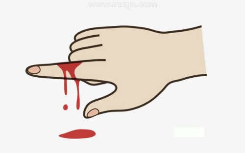 夢(mèng)見(jiàn)血是什么征兆