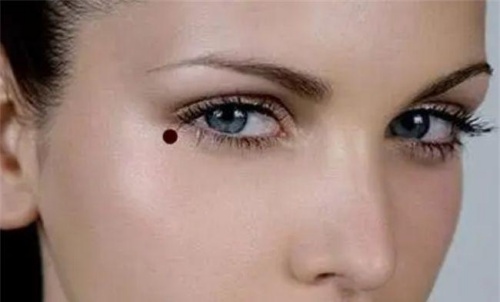 女人最不吉利的5顆痣