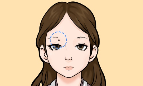 眉頭下方有痣代表什么?