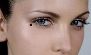 女人最不吉利的5顆痣