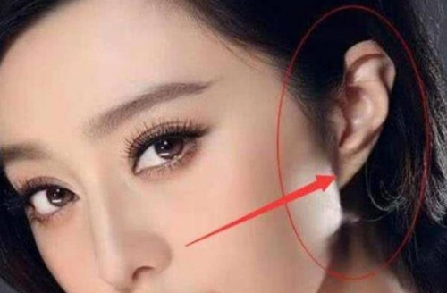 沒有耳垂的人命運(yùn)怎么樣