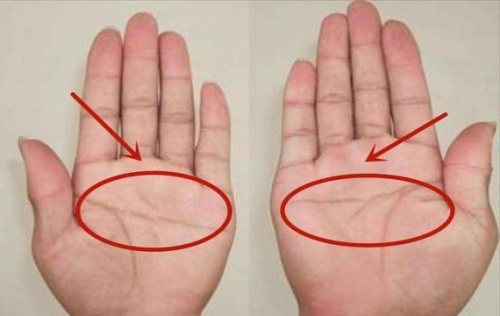 斷掌紋的男人克妻子嗎