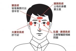 面部哪些痣必須點(diǎn)掉