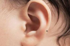 女人耳朵有痣代表什么意思