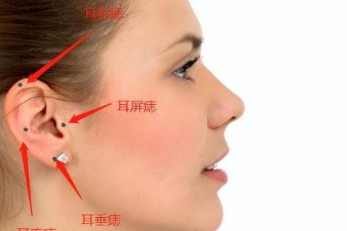 女人右耳朵有痣代表什么