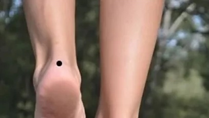 左腳腳后跟有痣的女人代表什么