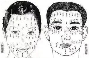 富貴痣在臉上哪些部位