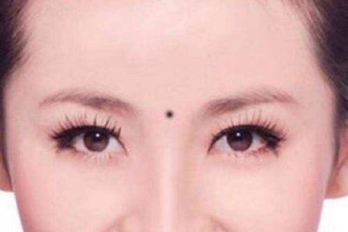 兩眉中間有痣代表什么意思