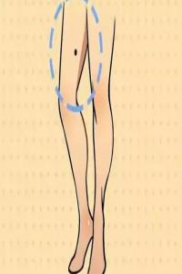 大腿上有痣代表什么意思