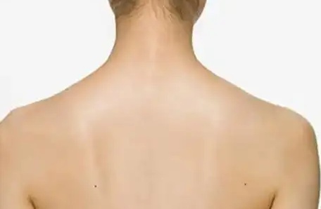肩胛骨長痣說明什么？