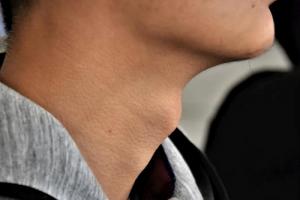 男人有喉結(jié)的面相風(fēng)水