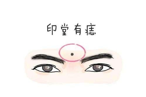 印堂有痣的男人代表什么意思