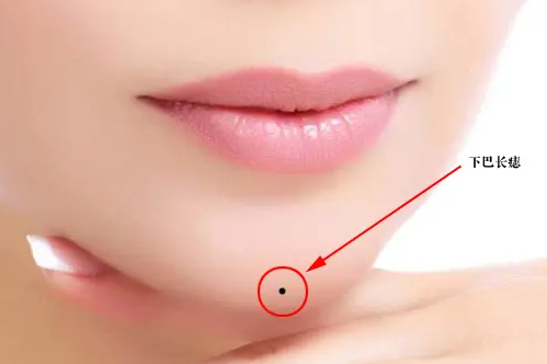 下巴底下抬頭痣代表什么