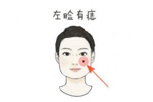 左臉有痣的女人代表什么