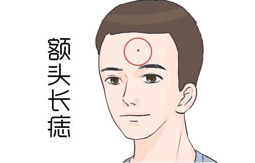 額頭有痣的男人有什么寓意