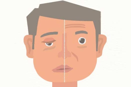 嘴巴歪的男人是什么面相