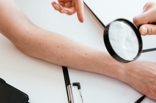 男人右胳膊最吉利的痣