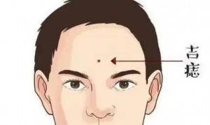 男人臉上哪里長痣最有福氣？